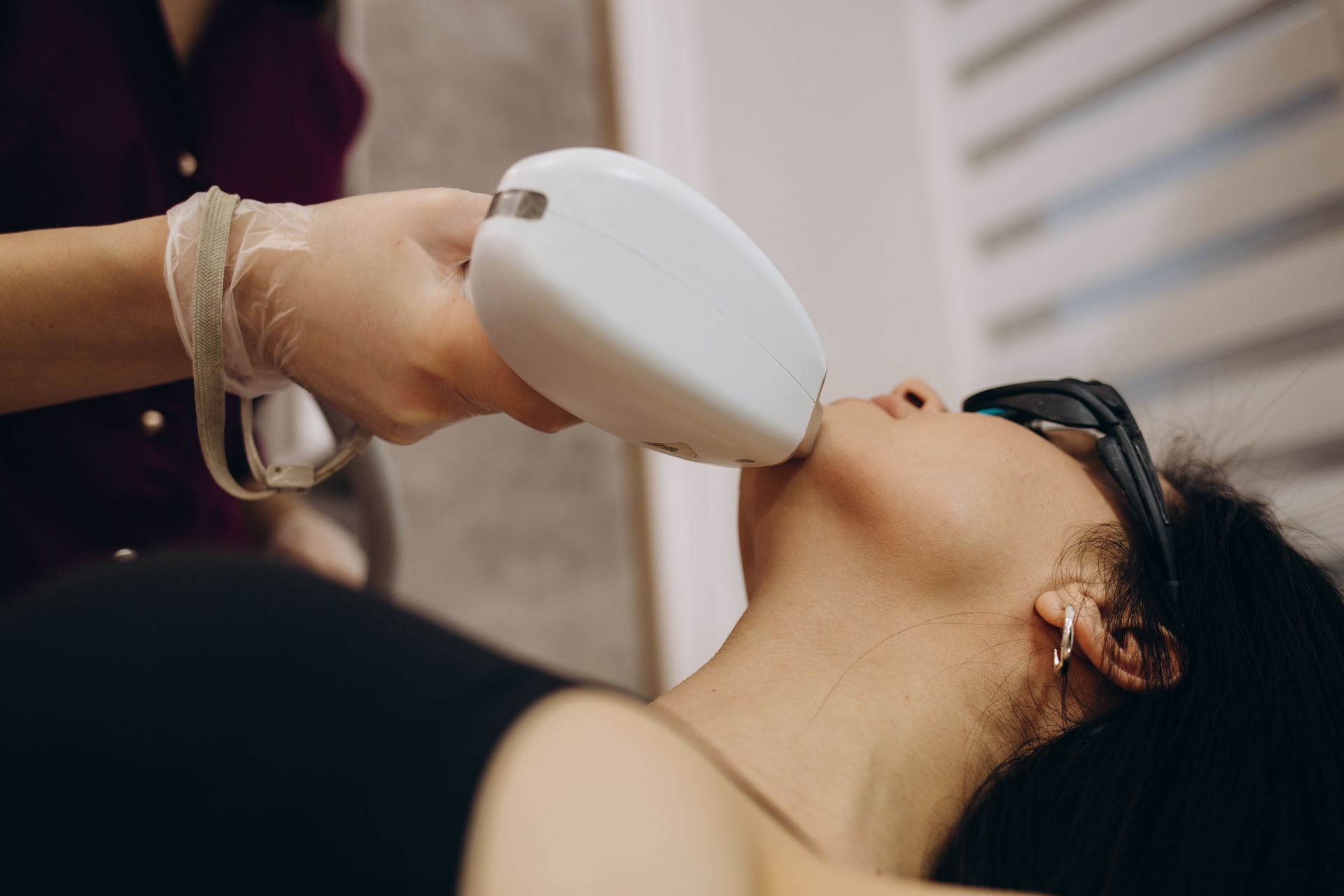 hair removal by doctor
