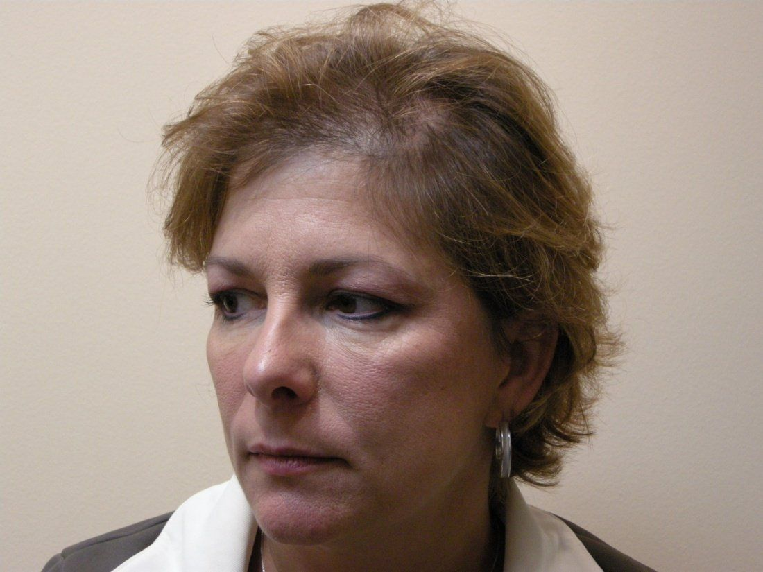 Woman with short brown hair looking off to the side, wearing a collared shirt.