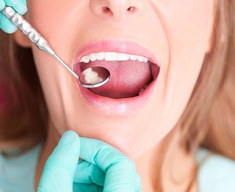 Dental fillings Sunland dental