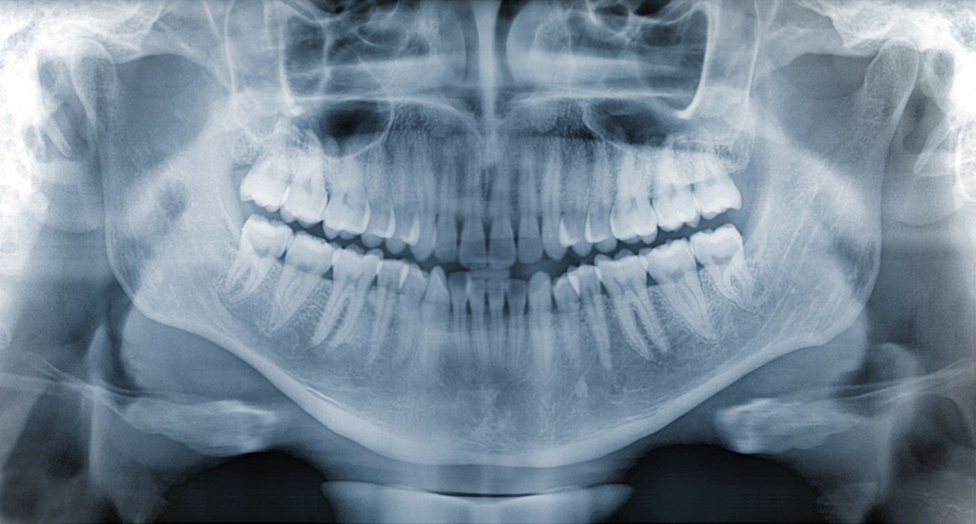 dental x ray
