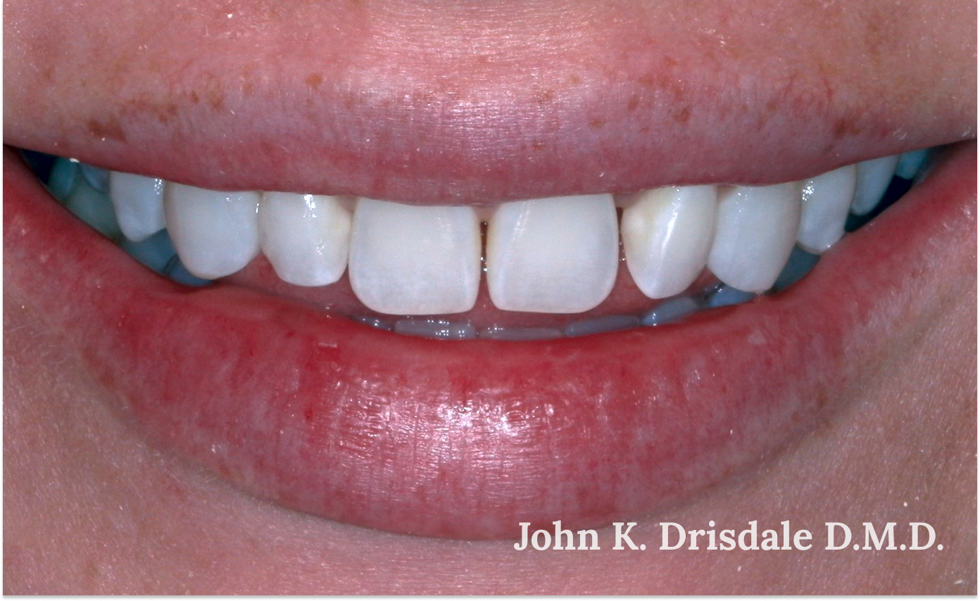 A close up of a person 's teeth with john k. driscole d.m.d. written on the bottom