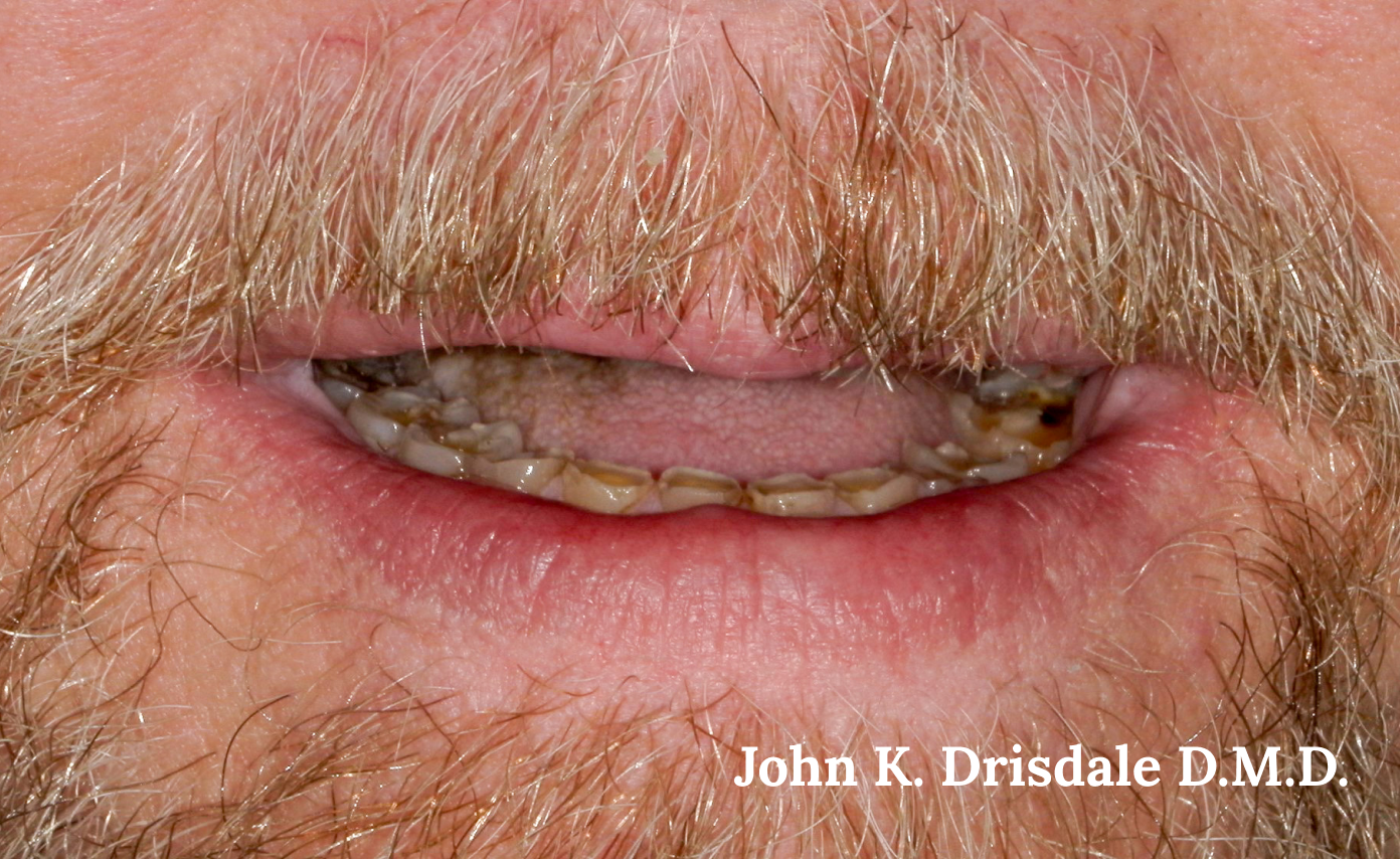 A close up of a man 's mouth with a beard.