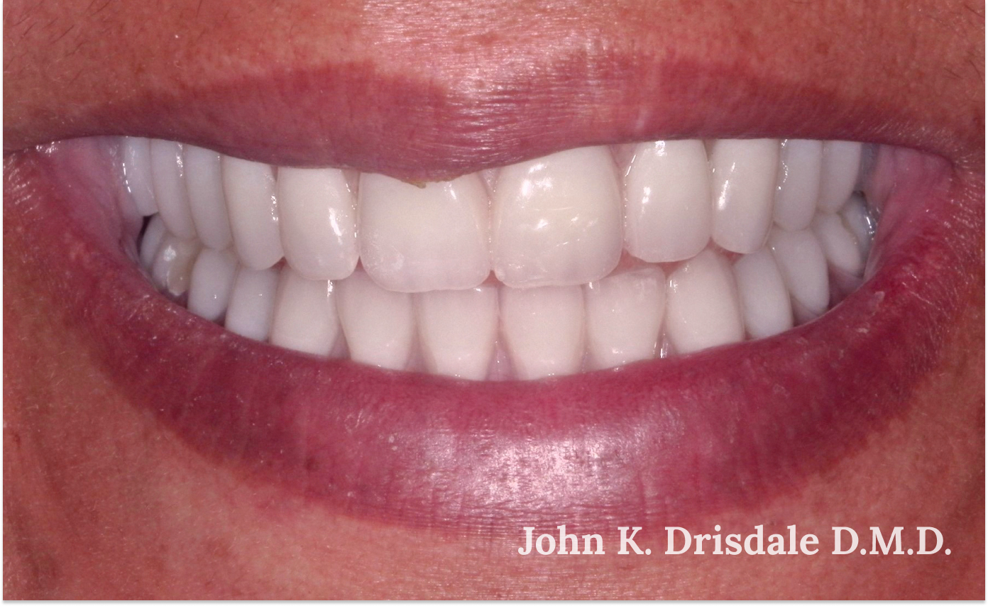 A close up of a woman 's teeth with john k. driscole d.m.d. written on the bottom