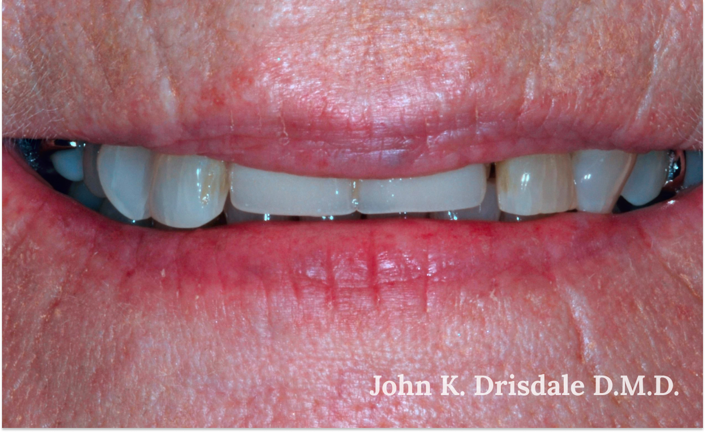 A close up of a person 's mouth by john k. driscole d.m.d.