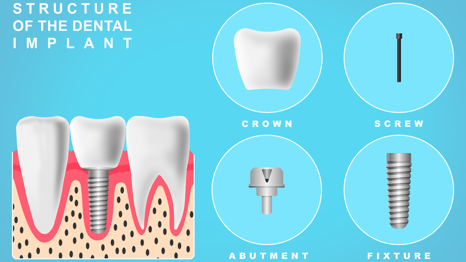ADVANCED DENTAL IMPLANT PROCEDURES