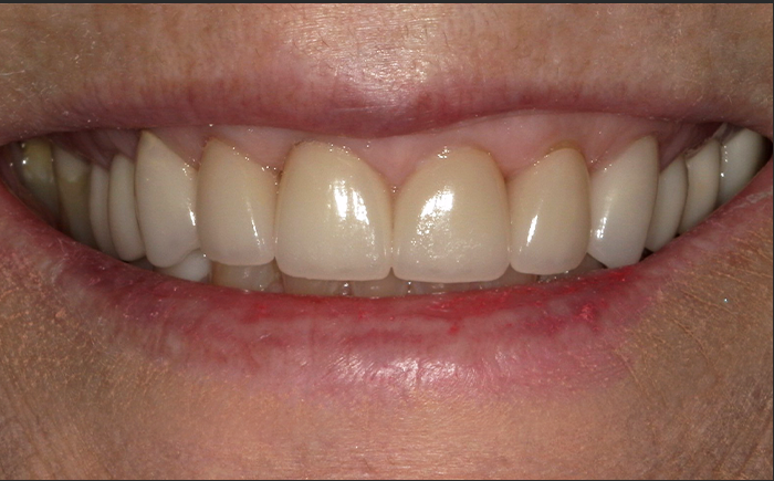 A close up of a person 's teeth by john k. driscole d.m.d.