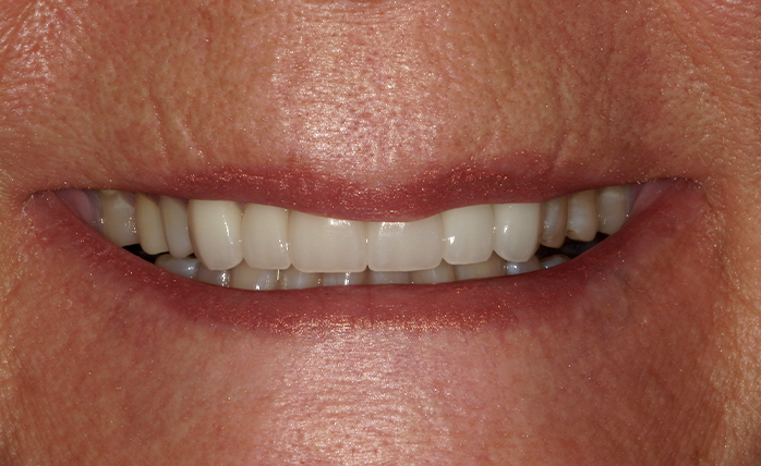 A close up of a woman 's smile taken by john k. driscoll d.m.d.