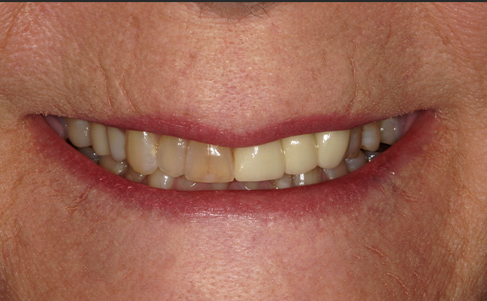 A close up of a woman 's smile with john k. driscole d.m.d. written on the bottom
