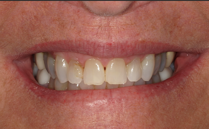 A close up of a person 's teeth taken by john k. driscole d.m.d.