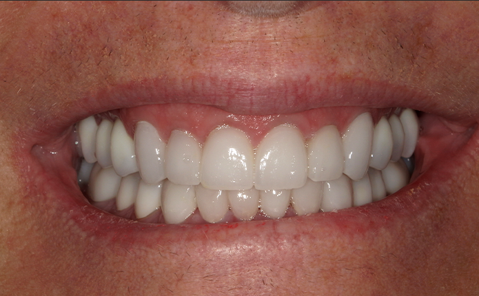 A close up of a woman 's teeth with john k. driscole d.m.d. written on the bottom