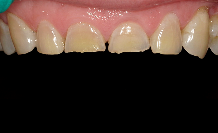 A close up of a person 's mouth by john k. driscole d.m.d.
