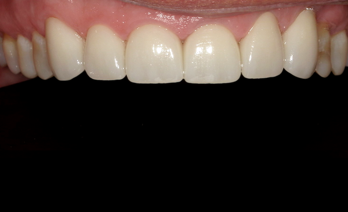 A close up of a person 's teeth by john k. driscole d.m.d.