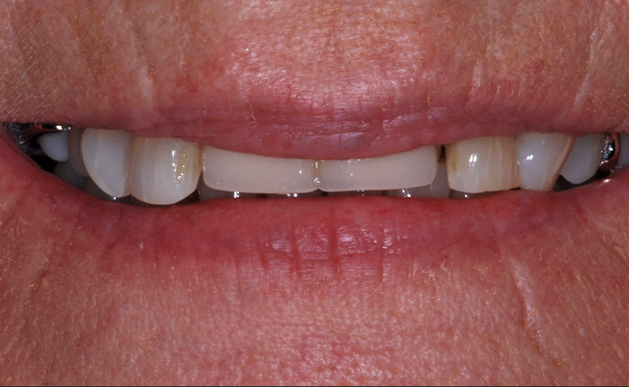 A close up of a person 's teeth with john k. driscole d.m.d. written on the bottom
