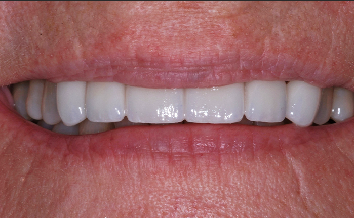 A close up of a woman 's teeth by john k. driscole d.m.d.