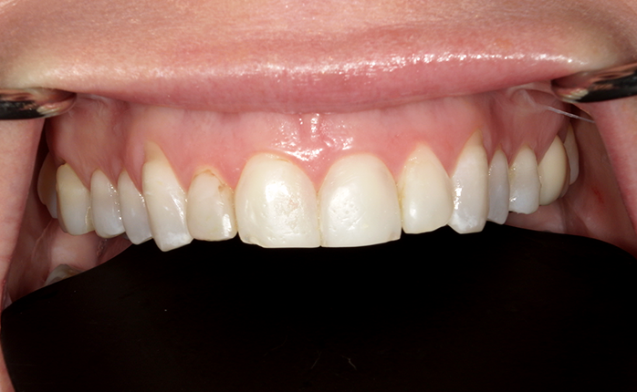 A close up of a person 's teeth by john k. driscoll d.m.d.