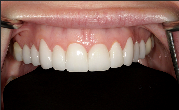 A close up of a person 's teeth taken by john k. driscole d.m.d.