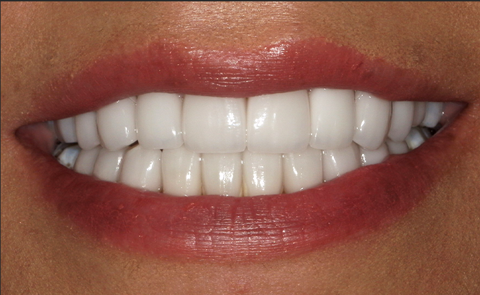 A close up of a woman 's teeth by john k. driscole d.m.d.