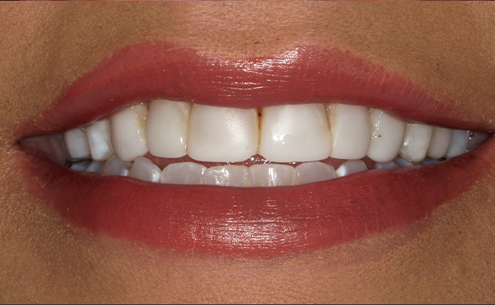 A close up of a person 's teeth with john k. driscole d.m.d. written on the bottom