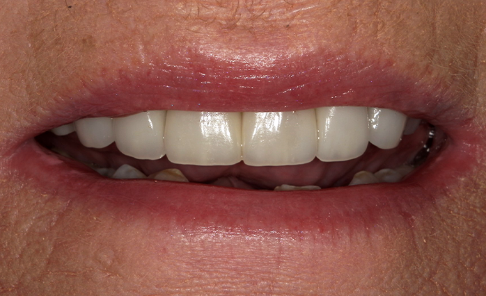 A close up of a woman 's teeth by john k. driscole d.m.d.