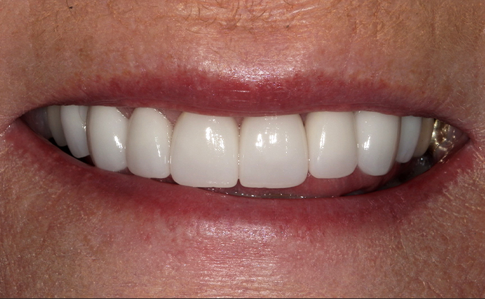 A close up of a woman 's teeth by john k. driscole d.m.d.