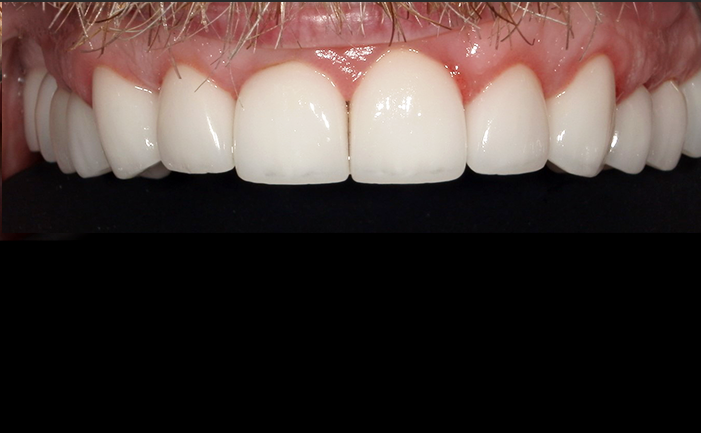 A close up of a person 's teeth by john k. driscoll d.m.d.