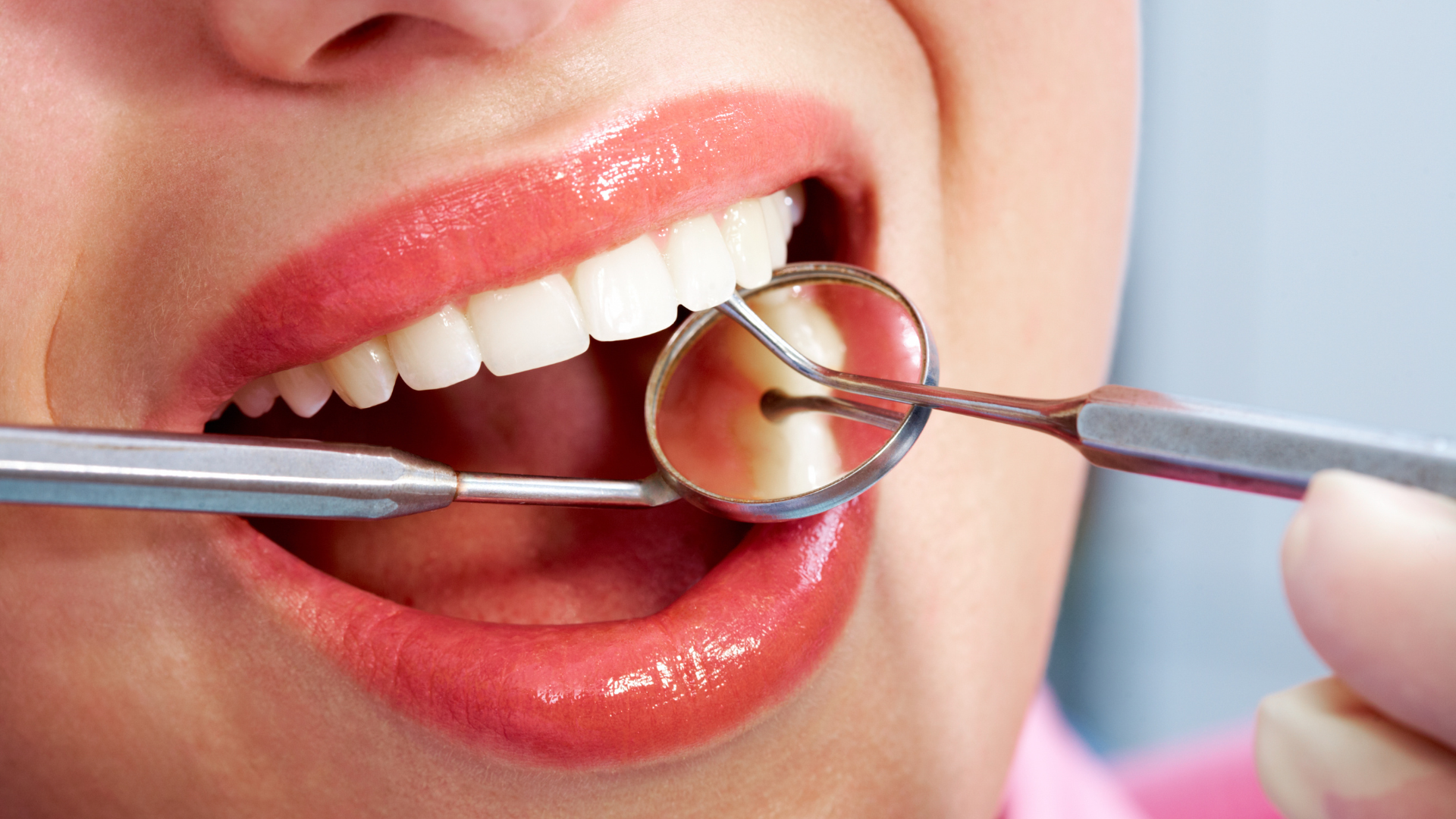 a woman is getting her teeth examined by a dentist .