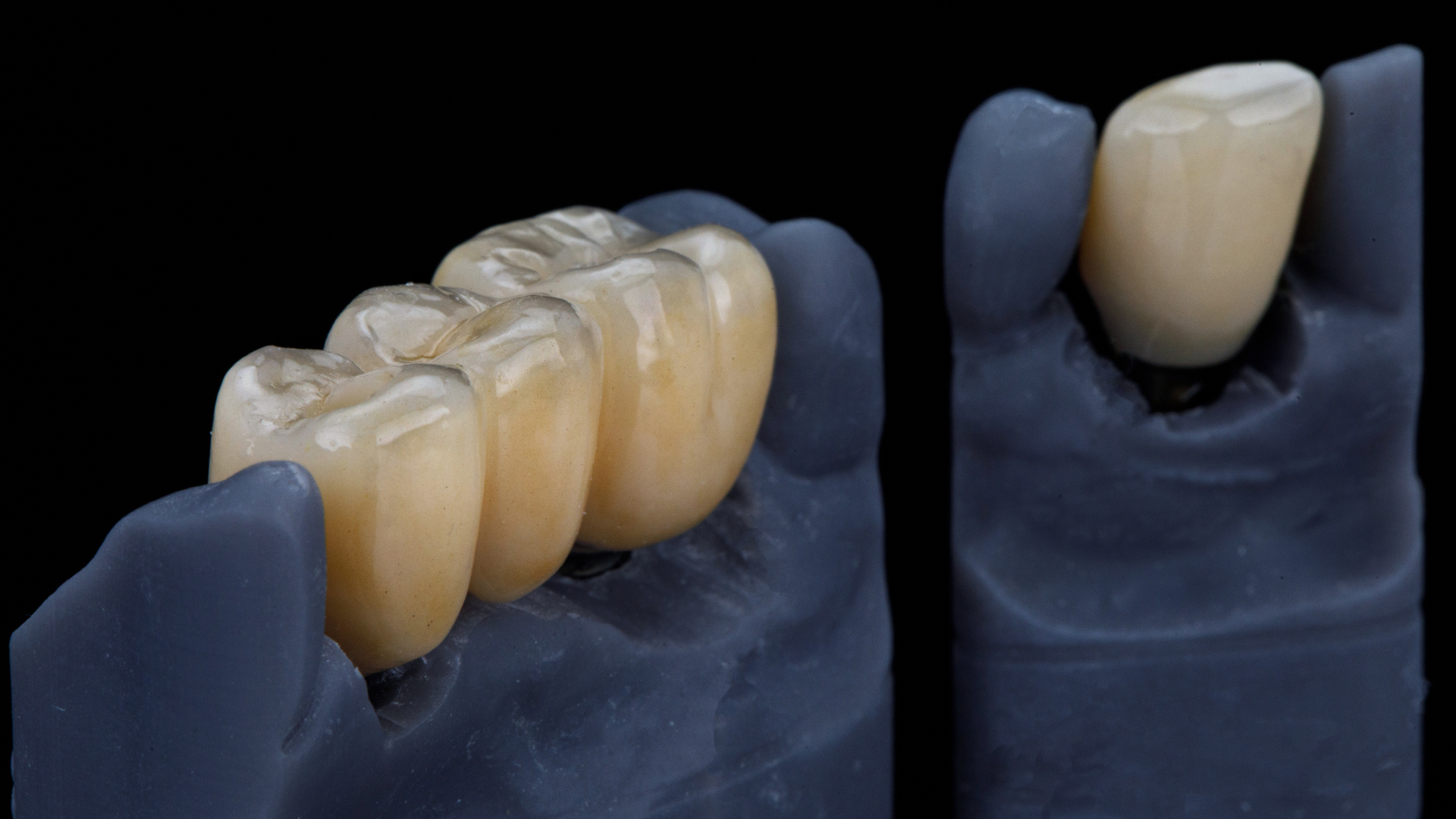 a close up of a model of a dental bridge on a black background .