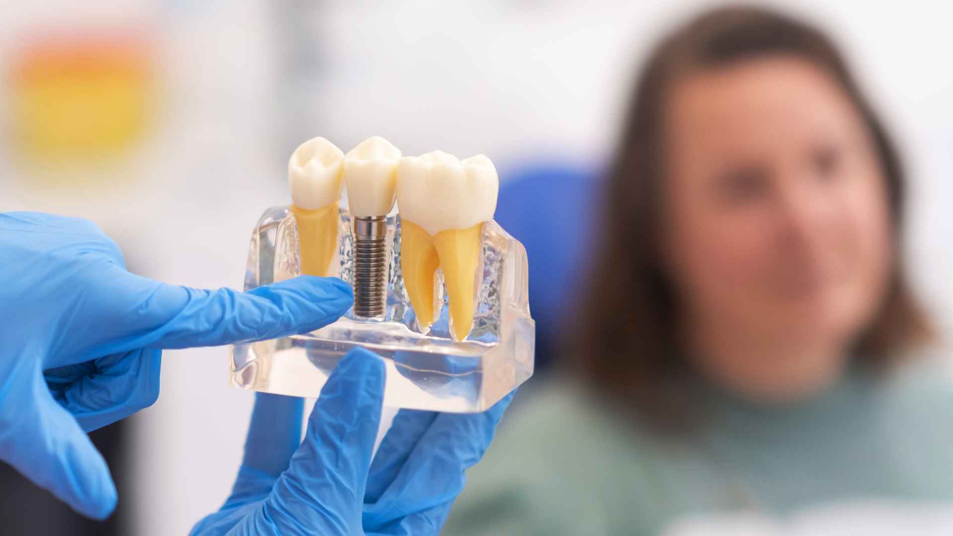 a dentist is holding a model of dental implants in front of a patient .
