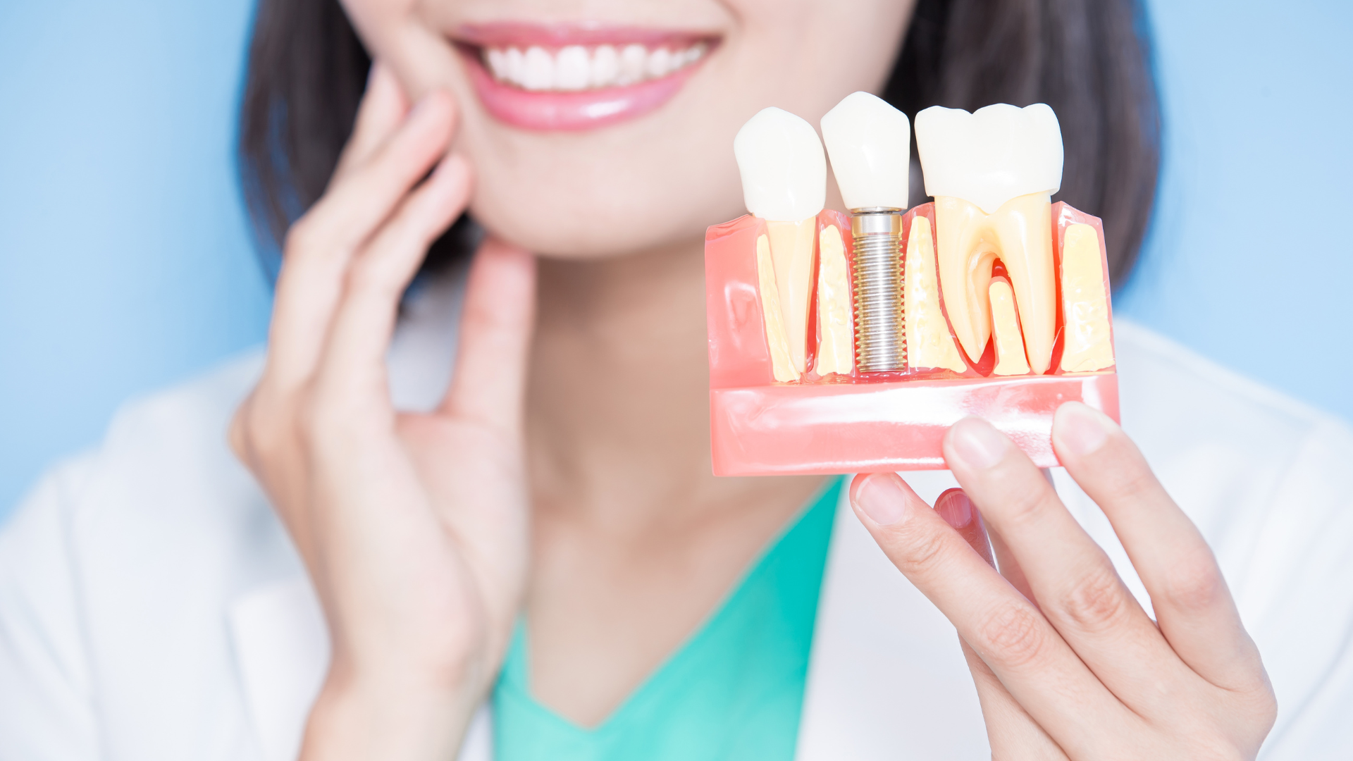 a woman is holding a model of dental implants in her hands .