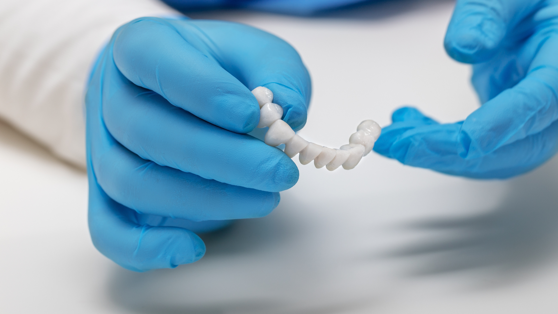 a person wearing blue gloves is holding a dental bridge in their hands .