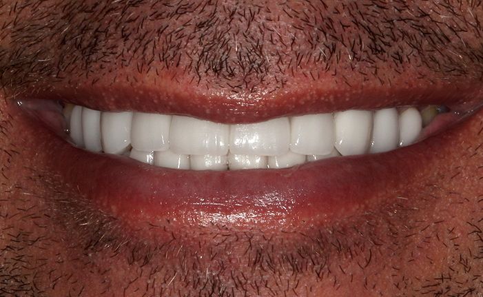 A close up of a person 's teeth taken by john k. driscole d.m.d.