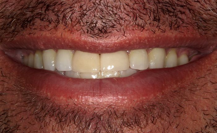 A close up of a person 's teeth taken by john k. driscole d.m.d.