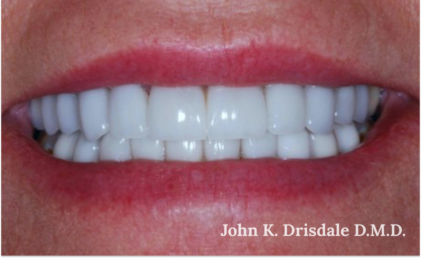 A close up of a woman 's teeth taken by john k. driscole d.m.d.