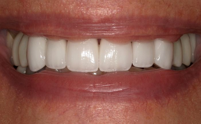 A close up of a woman 's teeth taken by john k. driscole d.m.d.