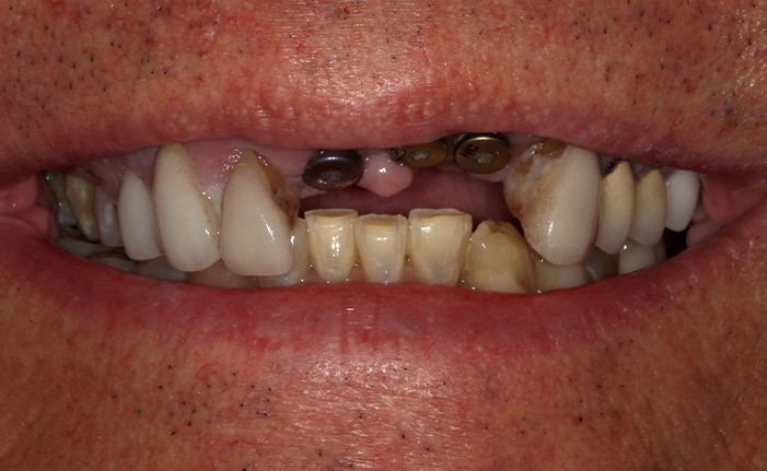 A close up of a man 's mouth with a beard.