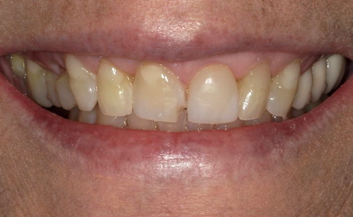 A close up of a person 's teeth by john k. driscoll d.m.d.