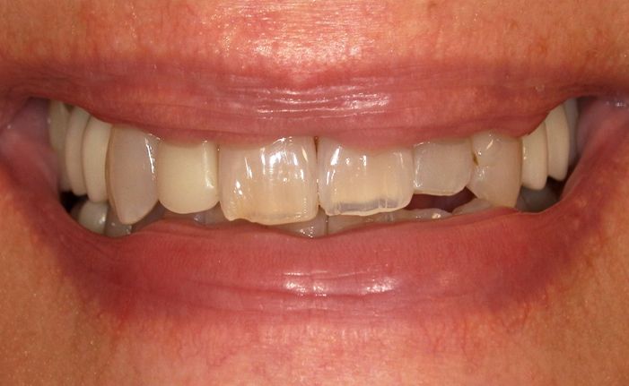 A close up of a woman 's teeth by john k. driscole d.m.d.