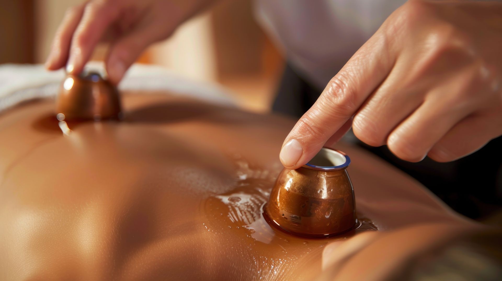 A person is getting a massage with cups on their back.