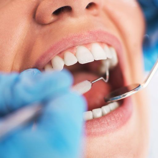 Dental Checkup – Libby, MO – Northwest Community Health