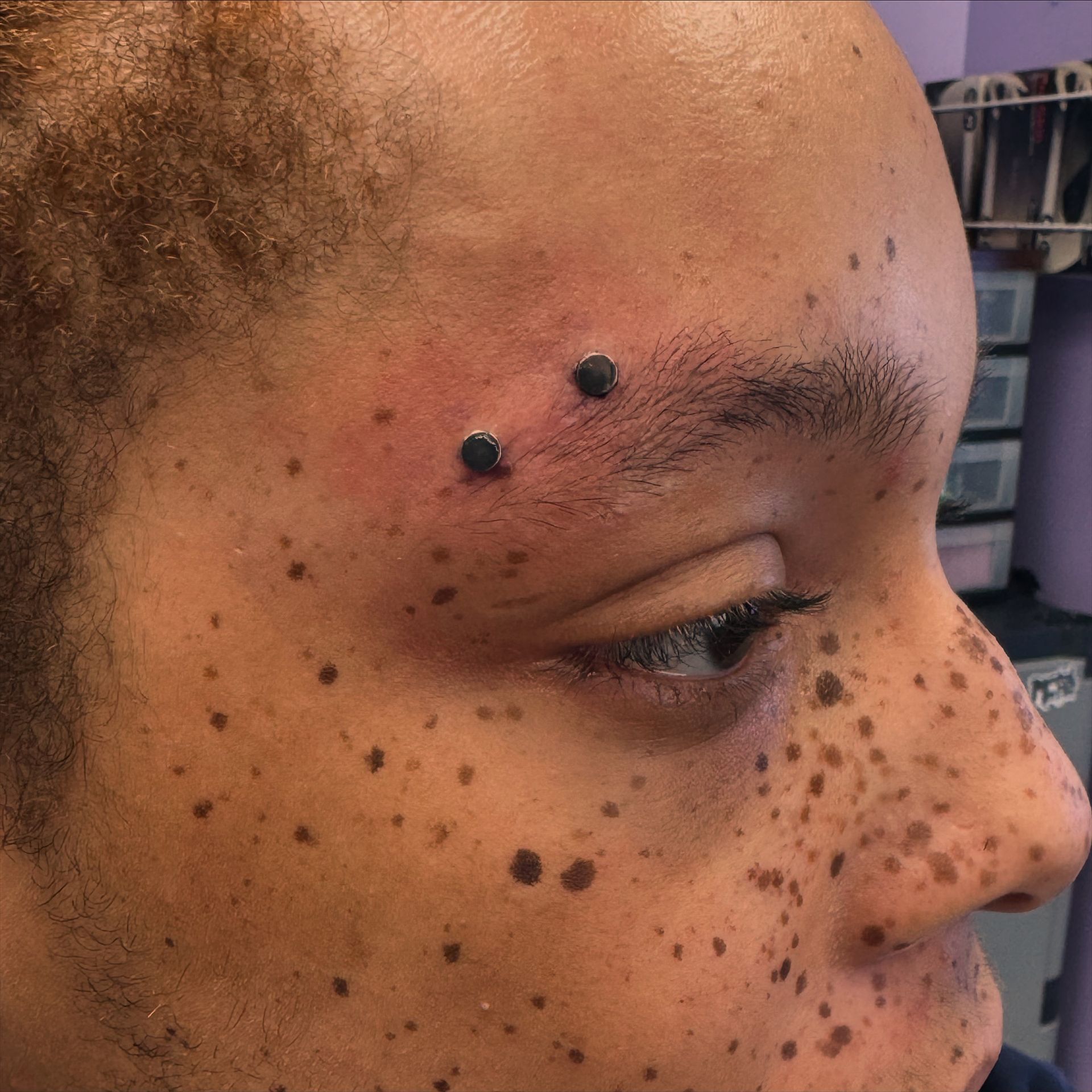 Close-up side profile of a face with many dark freckles and two small eyebrow piercings