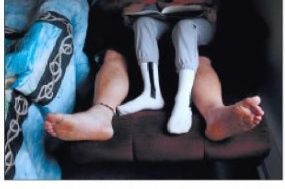 Two people lying on a couch, one wearing gray pants and white socks, both feet facing the camera