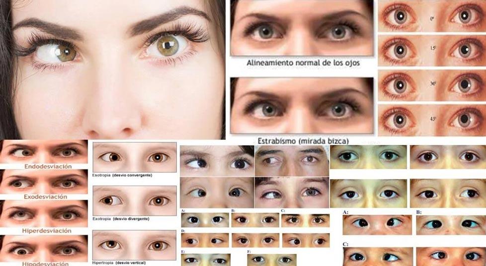 DR. RICARDO RAMOS -atención a retina