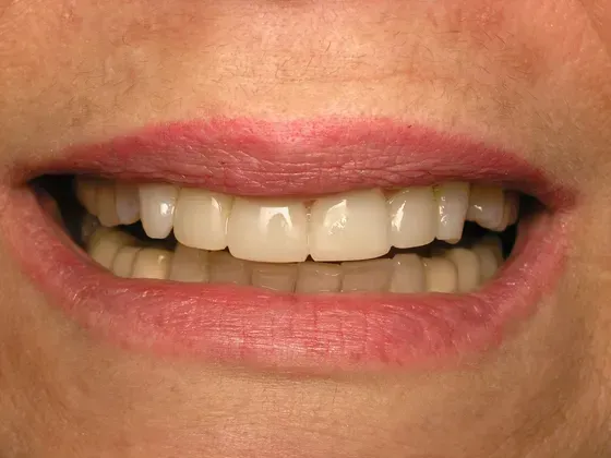 A close up of a woman 's mouth with white teeth and red lips. A close up of a woman 's mouth with white teeth and red lips.