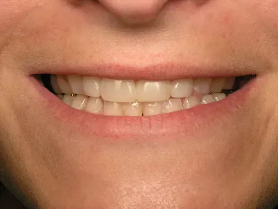 A close up of a woman 's smile with white teeth. A close up of a woman 's smile with white teeth.
