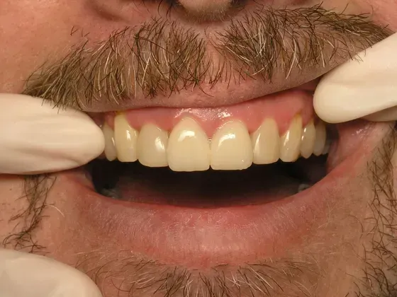 A close up of a man 's teeth with gloves on. A close up of a man 's teeth with gloves on.