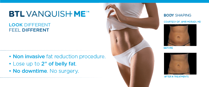 BTL Vanquish Me informative banner
