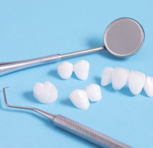 Dental Lumineers — Lemont, IL — John Mastrud DDS Dental Lumineers — Lemont, IL — John Mastrud DDS