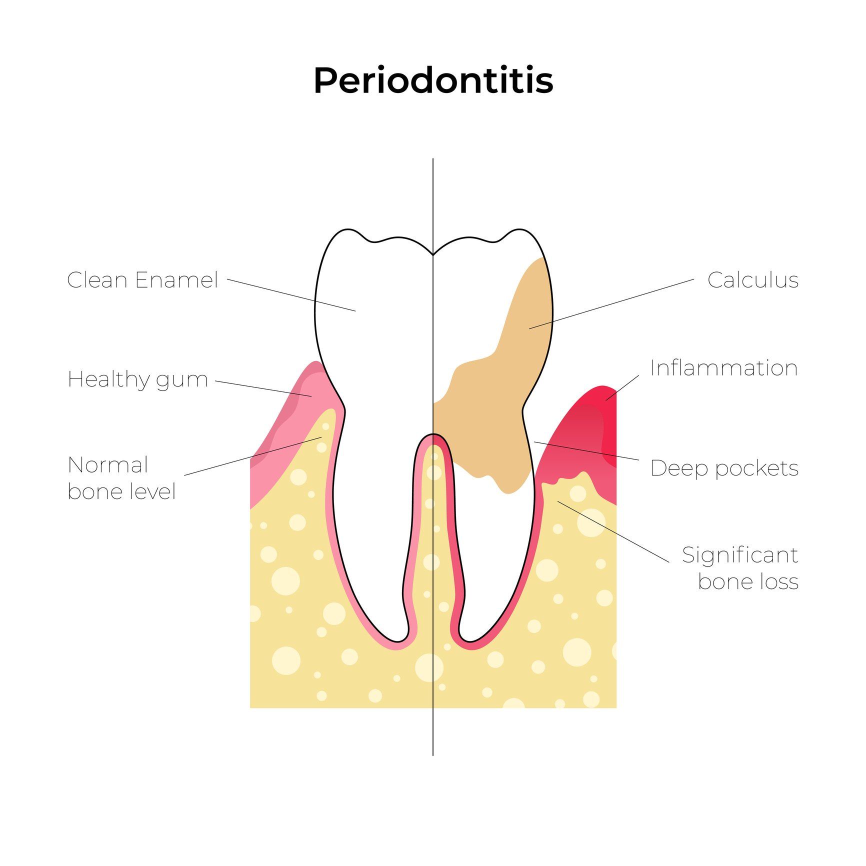 Woman Having Gum Problems — Lemont, IL — John Mastrud DDS Woman Having Gum Problems — Lemont, IL — John Mastrud DDS
