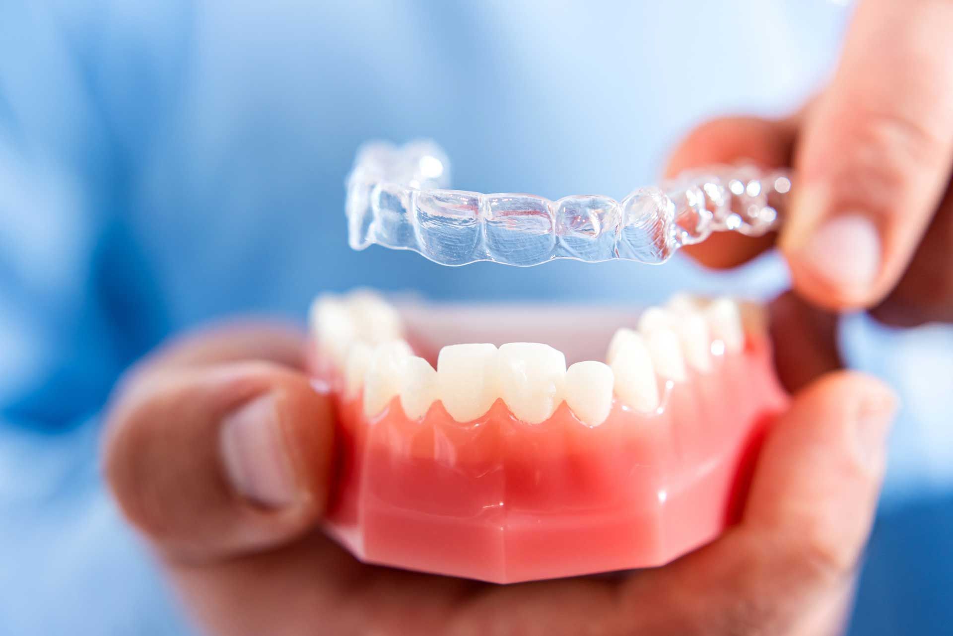 Hands holding clear aligner over a model of teeth, showcasing teeth straightening treatment.