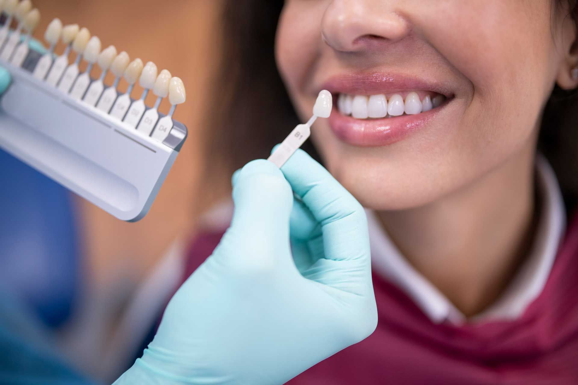 Dentist matching tooth color with shade guide to patient's teeth in a dental office.